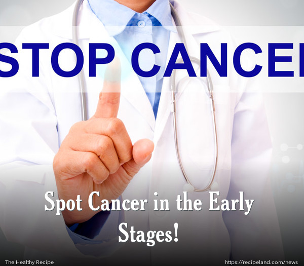 Spot Cancer in the Early Stages!