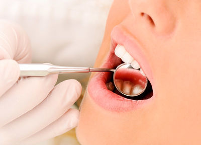7 Health Issues Revealed by Your Teeth