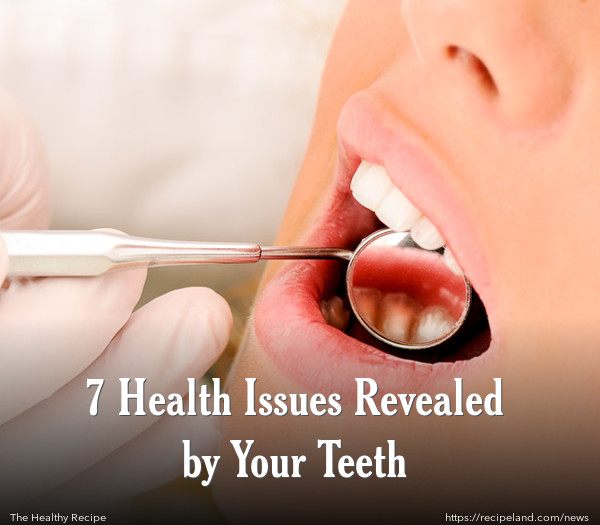 7 Health Issues Revealed by Your Teeth
